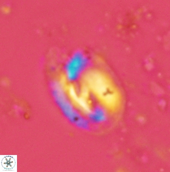 Helicosphaera grandeporis 2459