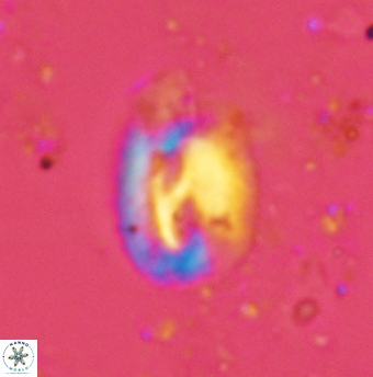 Helicosphaera grandeporis 2460