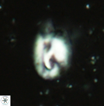 Helicosphaera grandeporis 2461