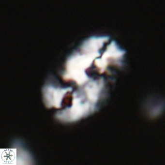 Helicosphaera huangii VR 33485