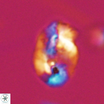 Helicosphaera huangii VR 33487