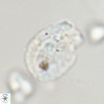 Helicosphaera huangii VR 33491