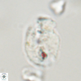 Helicosphaera huangii VR 33492