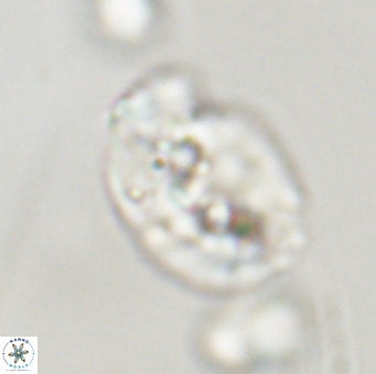 Helicosphaera huangii VR 33493