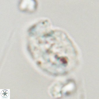 Helicosphaera huangii VR 33494