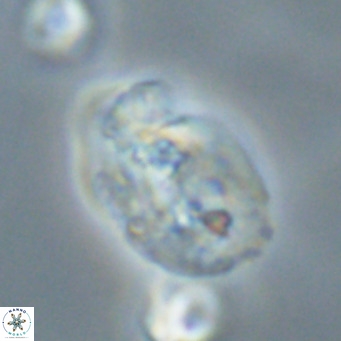 Helicosphaera huangii VR 33495