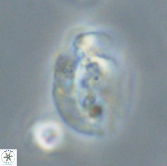 Helicosphaera huangii VR 33496