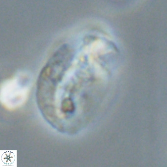 Helicosphaera huangii VR 33497