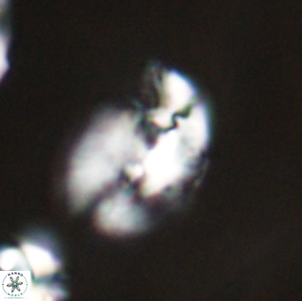 Helicosphaera huangii VR 33500