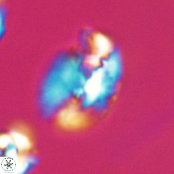 Helicosphaera huangii VR 33501