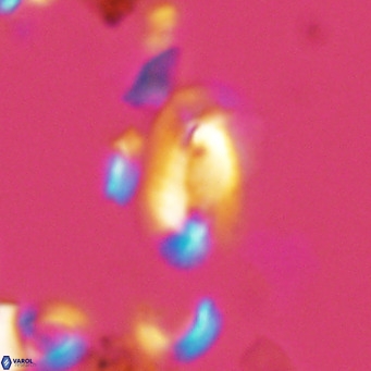 Helicosphaera hyalina VR 03708