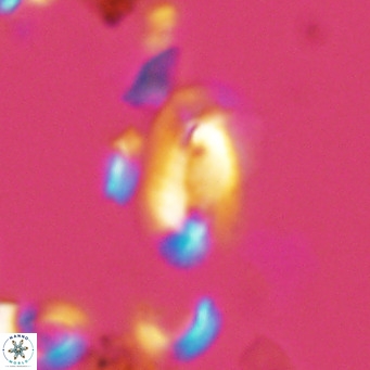 Helicosphaera hyalina VR 03708