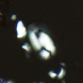 Helicosphaera hyalina VR 03710