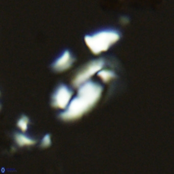 Helicosphaera hyalina VR 03711