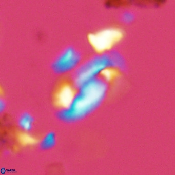 Helicosphaera hyalina VR 03712