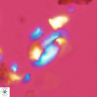 Helicosphaera hyalina VR 03712