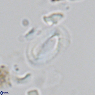 Helicosphaera hyalina VR 03714