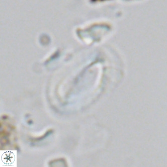 Helicosphaera hyalina VR 03714
