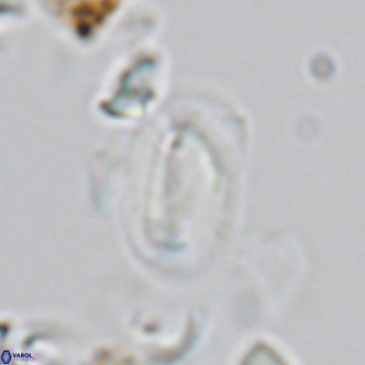 Helicosphaera hyalina VR 03715