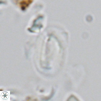 Helicosphaera hyalina VR 03715