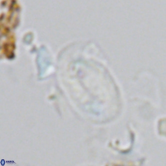 Helicosphaera hyalina VR 03717