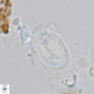 Helicosphaera hyalina VR 03717