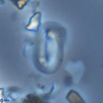 Helicosphaera hyalina VR 03722