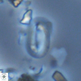 Helicosphaera hyalina VR 03722
