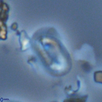 Helicosphaera hyalina VR 03723