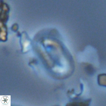 Helicosphaera hyalina VR 03723