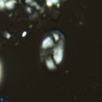 Helicosphaera hyalina VR 04735