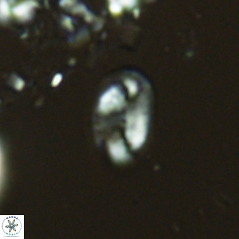 Helicosphaera hyalina VR 04735