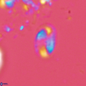 Helicosphaera hyalina VR 04736