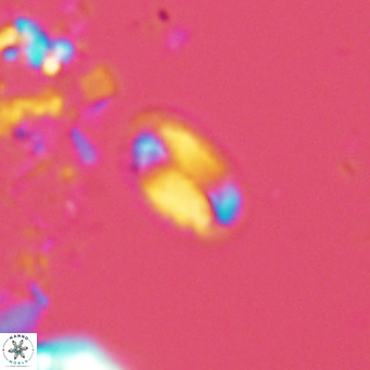 Helicosphaera hyalina VR 04737