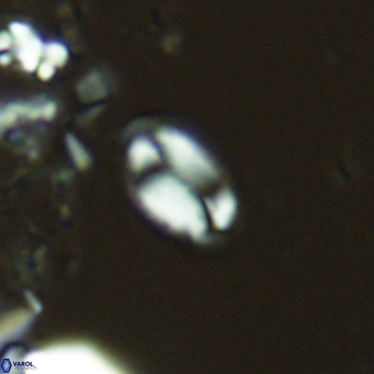 Helicosphaera hyalina VR 04738