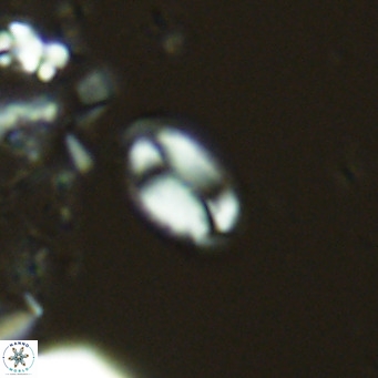 Helicosphaera hyalina VR 04738