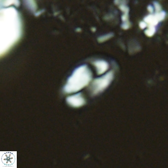 Helicosphaera hyalina VR 04739