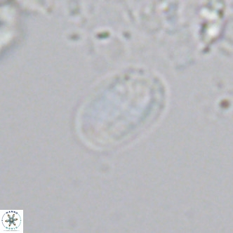 Helicosphaera hyalina VR 04741
