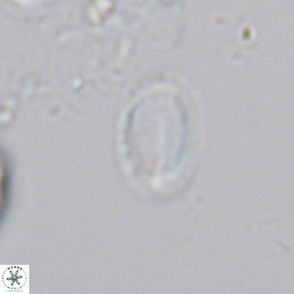 Helicosphaera hyalina VR 04742