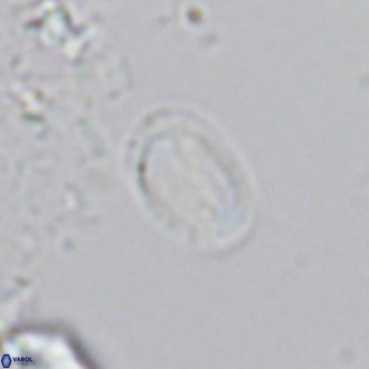 Helicosphaera hyalina VR 04744