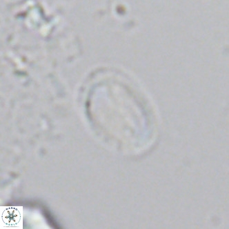 Helicosphaera hyalina VR 04744