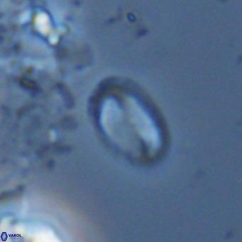 Helicosphaera hyalina VR 04745