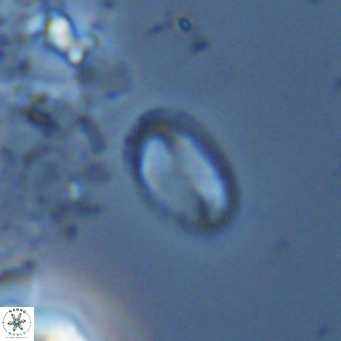 Helicosphaera hyalina VR 04745
