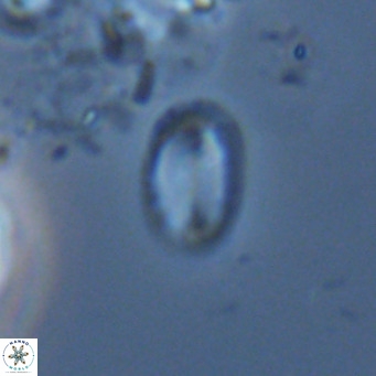 Helicosphaera hyalina VR 04746