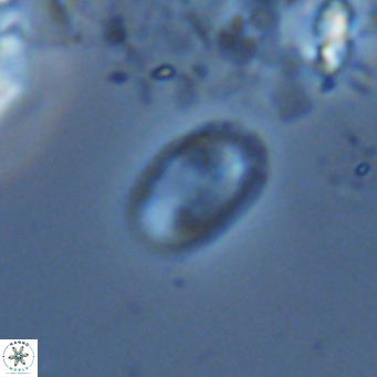 Helicosphaera hyalina VR 04747