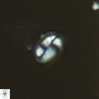 Helicosphaera hyalina VR 04994