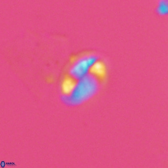 Helicosphaera hyalina VR 04995