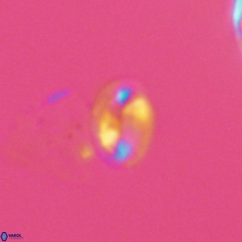 Helicosphaera hyalina VR 04996