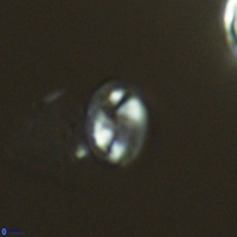 Helicosphaeranudus hyalina VR 04997