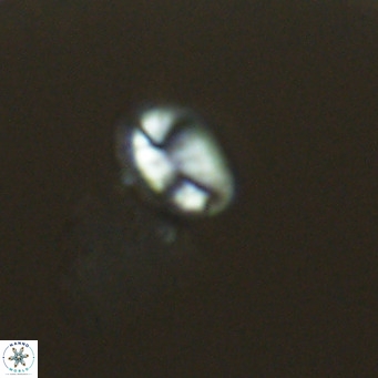 Helicosphaera hyalina VR 04998